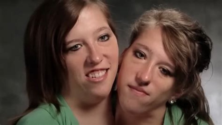 Abby and Brittany Hensel Age: The Extraordinary Journey of Conjoined Twins