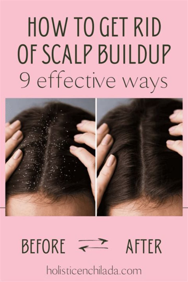 Best Scalp Cleanser for Build-Up: A Comprehensive Guide to Maintain Healthy Hair
