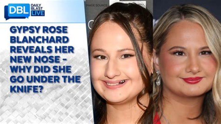 Gypsy Rose Blanchard: What Surgeries Did She Have as a Kid?