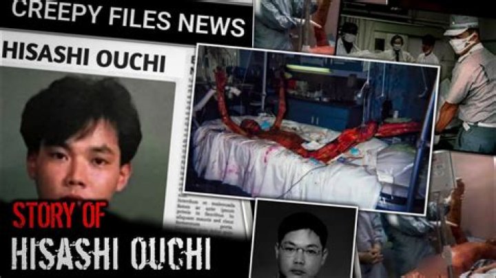 Hisashi Ouchi Pictures: A Deep Dive Into the Legacy of a Nuclear Tragedy