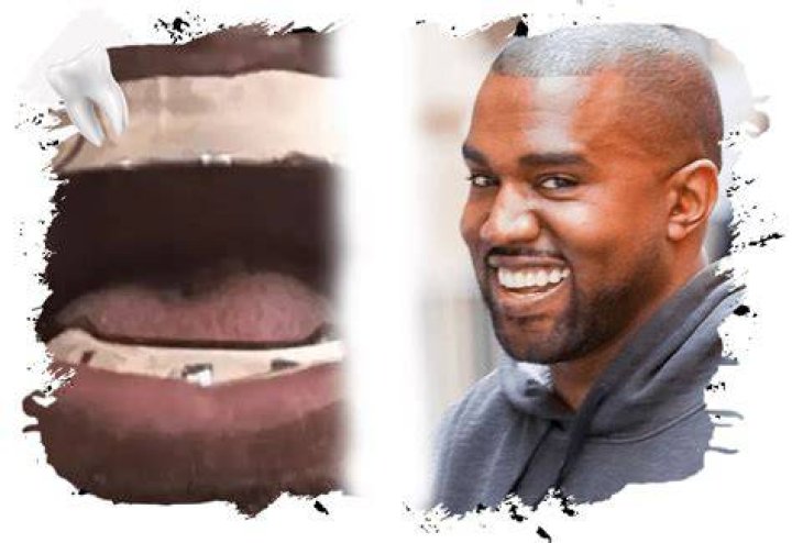 Kanye West Teeth 2025: A Comprehensive Look at His Dental Journey