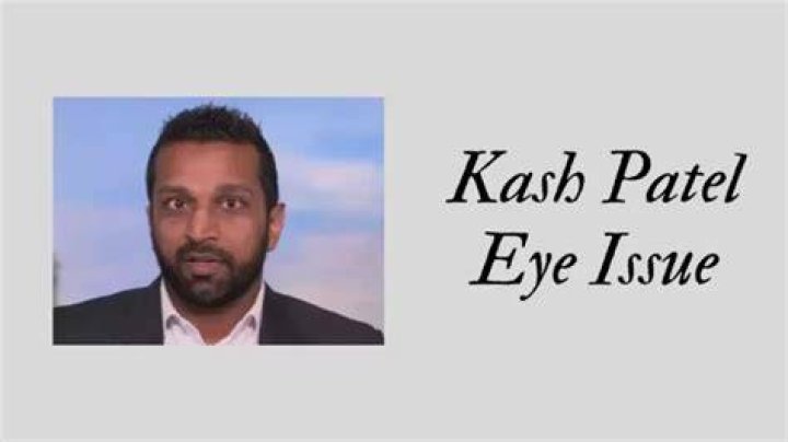 Kash Patel: Does He Have a Glass Eye?