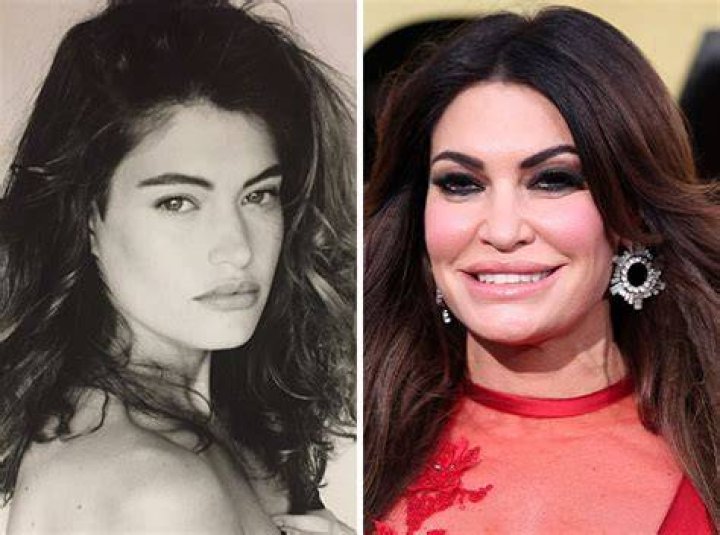 Kimberly Guilfoyle Before and After: A Transformation Story