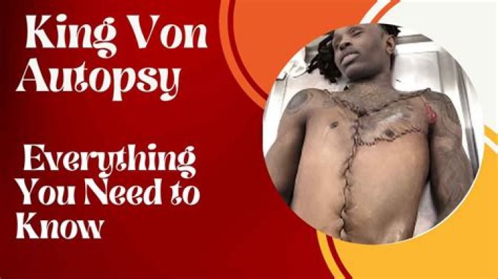 King Von Autopsy Photo: A Detailed Analysis and Its Impact on Fans