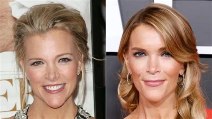 Megyn Kelly Weight Loss: Journey, Success Tips, and Healthy Living