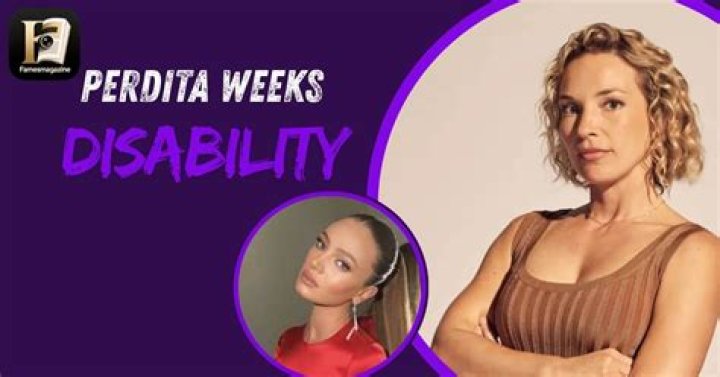 Perdita Weeks Disability: A Comprehensive Look into Her Journey and Challenges