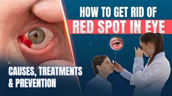 Red Pot Onkin Below Eye: Causes, Treatments, and Prevention