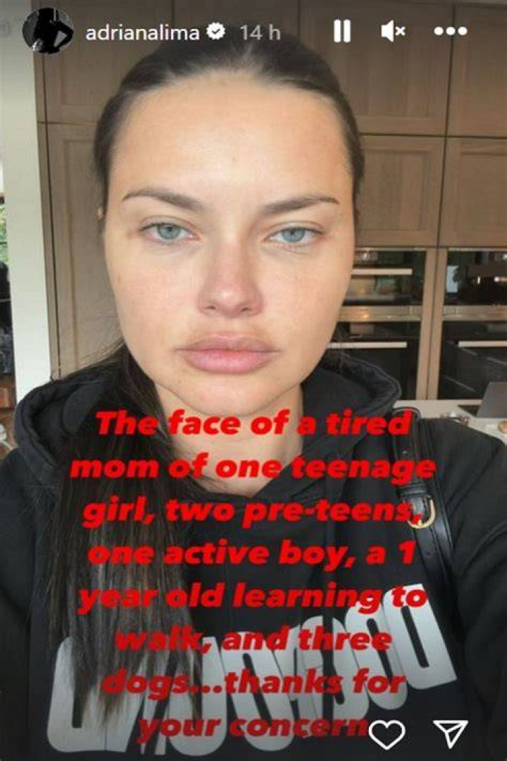 Remembering the Moment: Adriana Lima Top Falling Off and Her Unforgettable Career