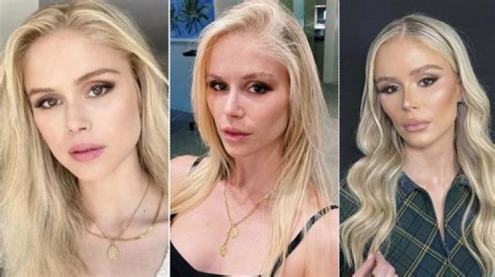 Sienna Miller's Appearance: Unpacking the Discussions Around Face Surgery