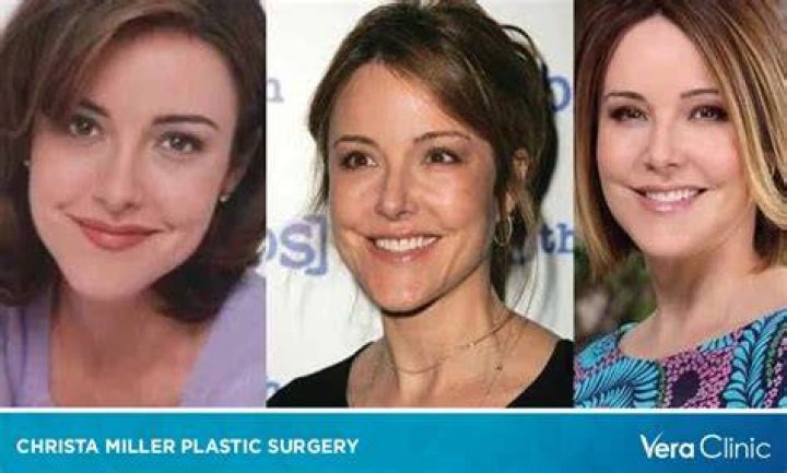 Sienna Miller Plastic Surgery: Exploring Her Beauty Evolution