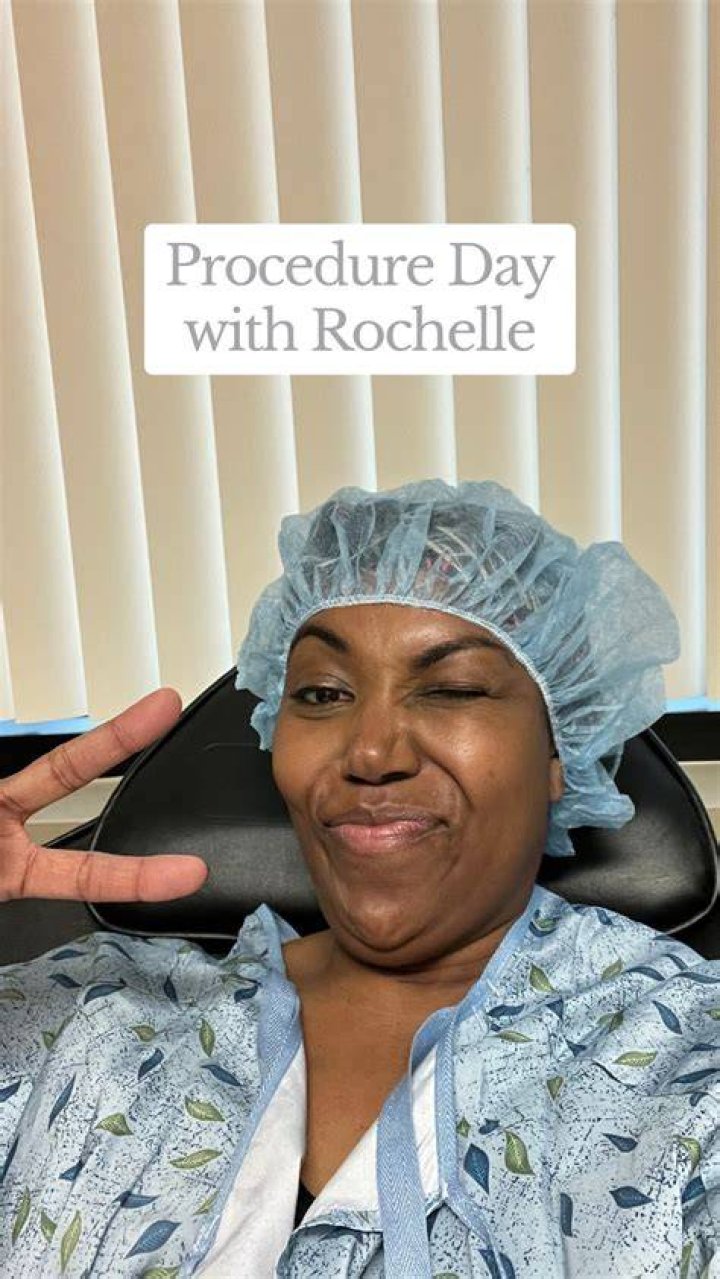 Sono Bello Abex: Remove Fat & Skin - See Amazing Results!