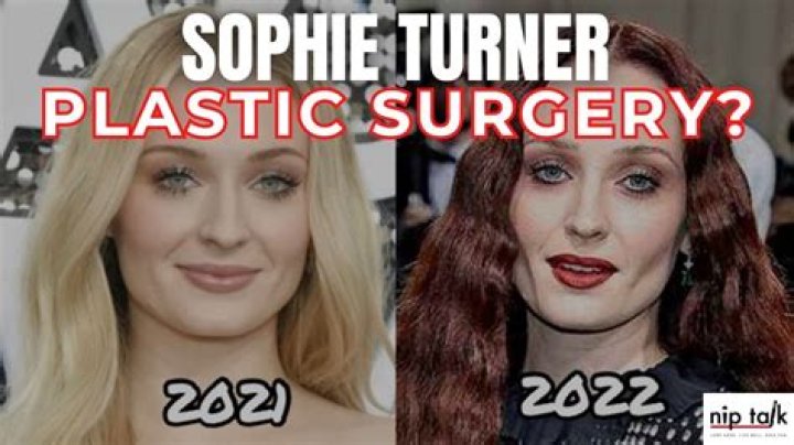 Sophie Rain Plastic Surgery: Before & After Transformation - What You Need to Know