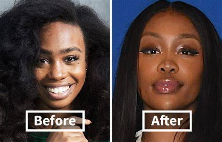 SZA Before Lip Filler: Tracing Her Journey and Evolving Look