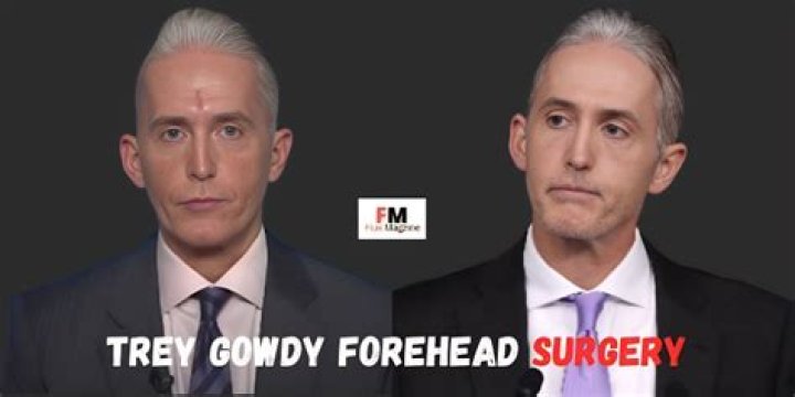 Trey Gowdy Face Surgery: Unpacking the Public Discussion