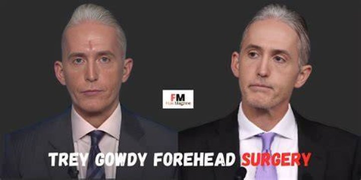 Trey Gowdy Plastic Surgery: A Comprehensive Exploration