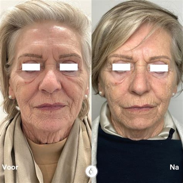 Try Miamimd Reviews Before and After: A Comprehensive Guide to Transformative Results