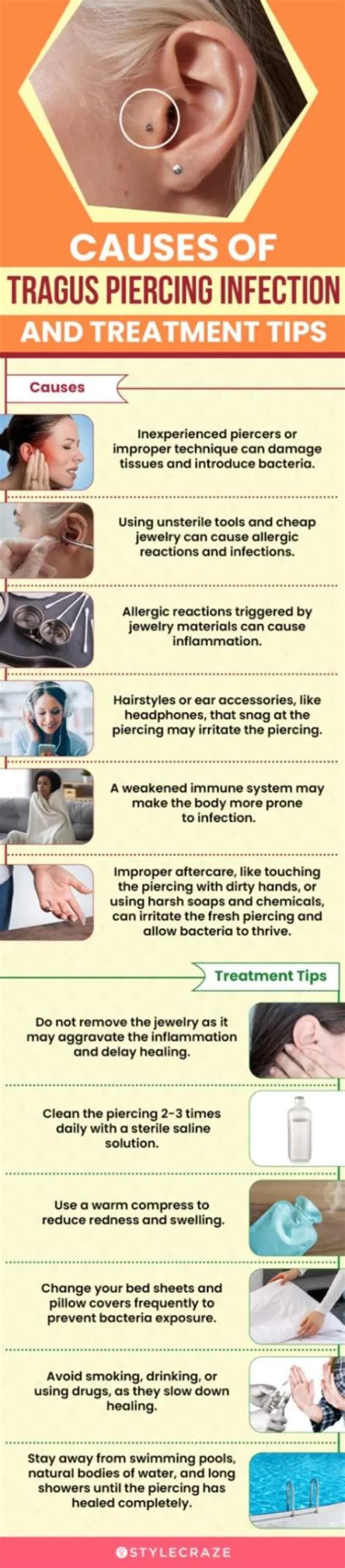 Understanding Infected Tragus: Causes, Symptoms, Treatment, and Prevention