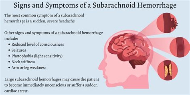 Understanding Subgaleal Hemorrhage: Causes, Symptoms, Diagnosis, and Treatment
